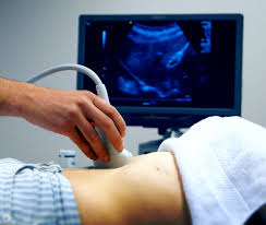 Ultrasound procedure